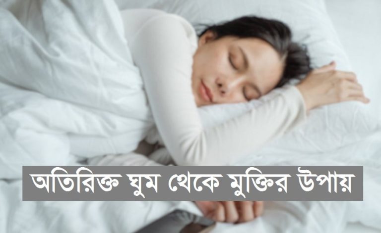 অতিরিক্ত ঘুম থেকে মুক্তির উপায়